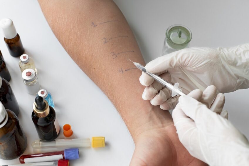 Allergy Testing Georgia
